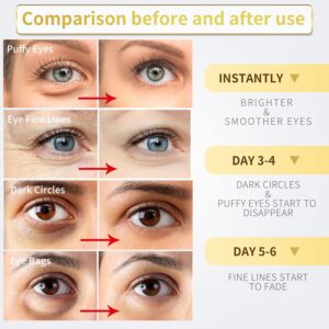 Under Eye Patches - 60 Pcs - 24K Gold Eye Mask- Puffy Eyes & Dark Circles Treatments,Reduce Under Eye Bags and Smooth Wrinkles,Eye Skin Care Pads With Collagen,Hyaluronic Acid & Castor Oil
