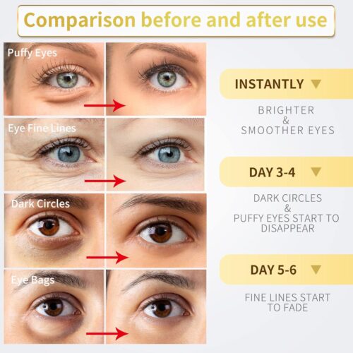 817SnkTt3zL._SL1500_ Under Eye Patches - 60 Pcs - 24K Gold Eye Mask- Puffy Eyes & Dark Circles Treatments,Reduce Under Eye Bags and Smooth Wrinkles,Eye Skin Care Pads With Collagen,Hyaluronic Acid & Castor Oil